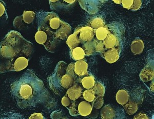 vizualizare cu Microscopul electronic Streptococcus pyogenes